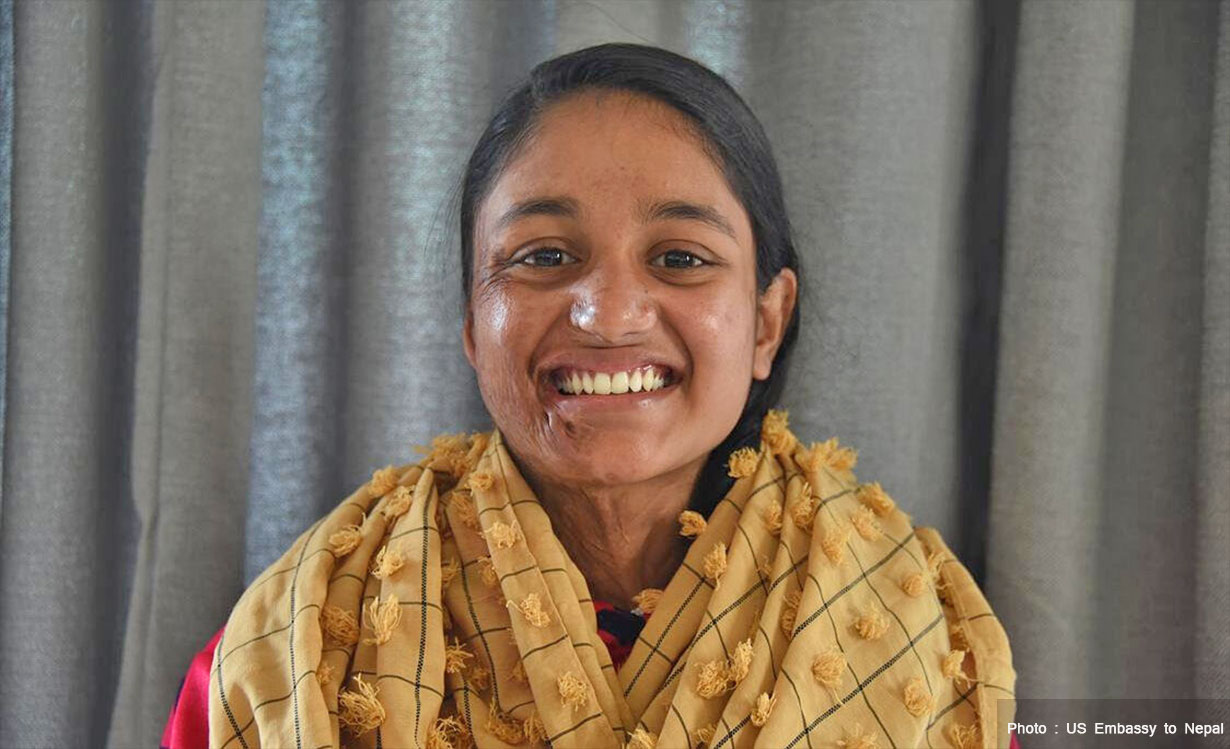 मुस्कान खातुनको बायोपिक बन्ने, जाे तेजाब आक्रमणमा परेकी थिइन्