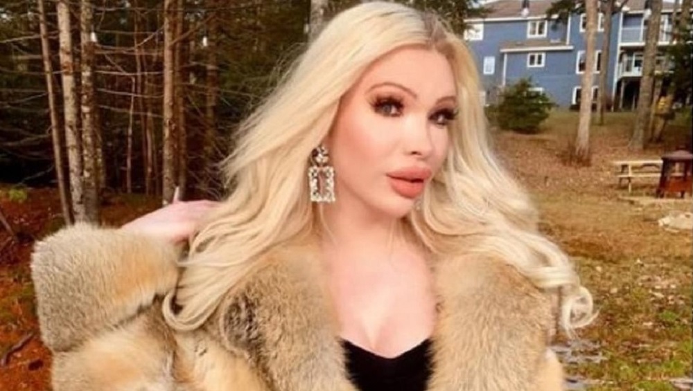 यिनको प्लास्टिक सर्जरीमा ८० लाख रुपैयाँ खर्च