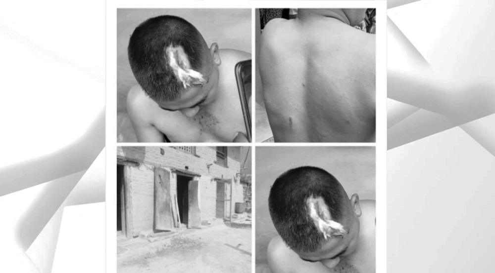 माओवादी आक्रमणबाट कांग्रेसका ४ उम्मेदवार गम्भीर घाइते