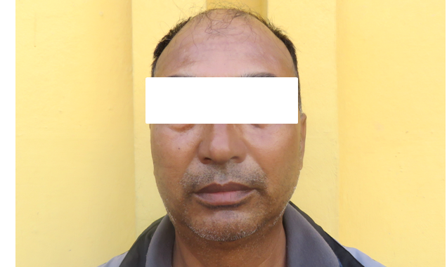 बालयौन दुरुपयोग आरोपी पक्राउ